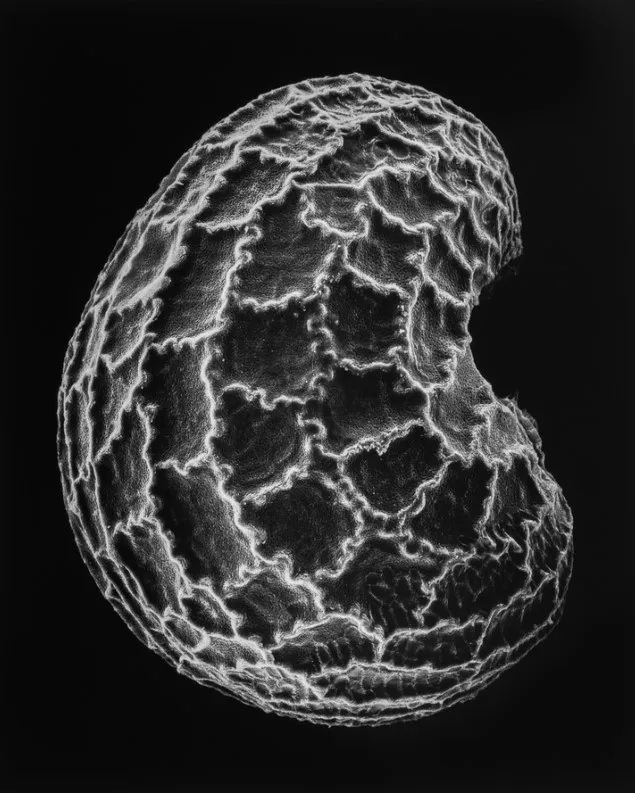 Claudia Fährenkemper, 15-02-2 Poppy Seed, 100x, 2002 (gelatin silver print, 20×15.75in), from the series Embryo. Courtesy of the artist and Stephen Bulger Gallery. © Claudia Fährenkemper