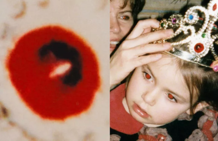 Ohne Titel, aus der Serie »Red-Eye Trompe l’oeil« (1998–2005), © Michel Campeau